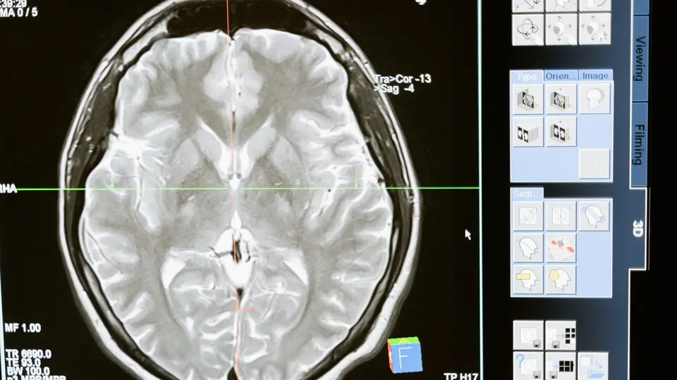 Functional MRI 3D brain render glowing in response to visual branding stimuli